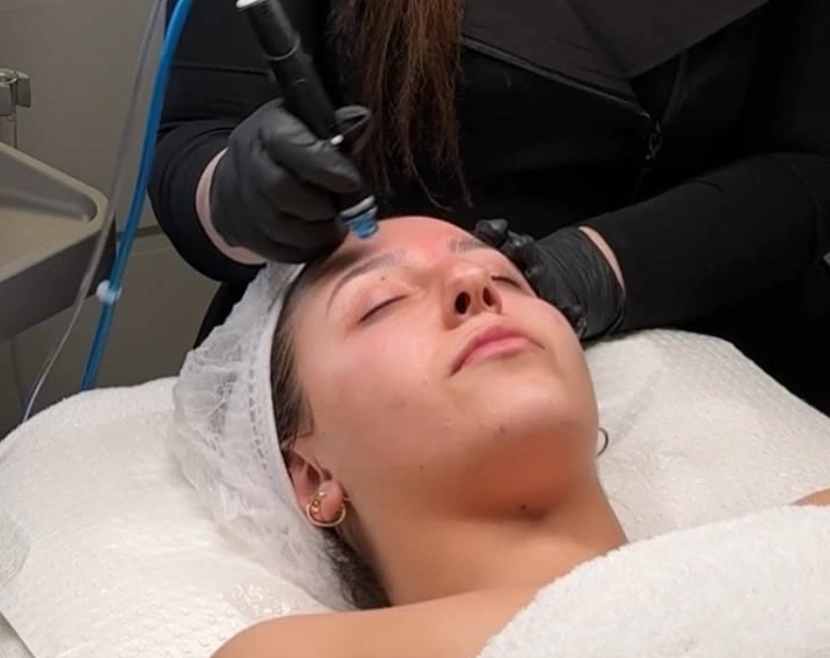 Deep cleansing and extraction facial at the Erothots salon